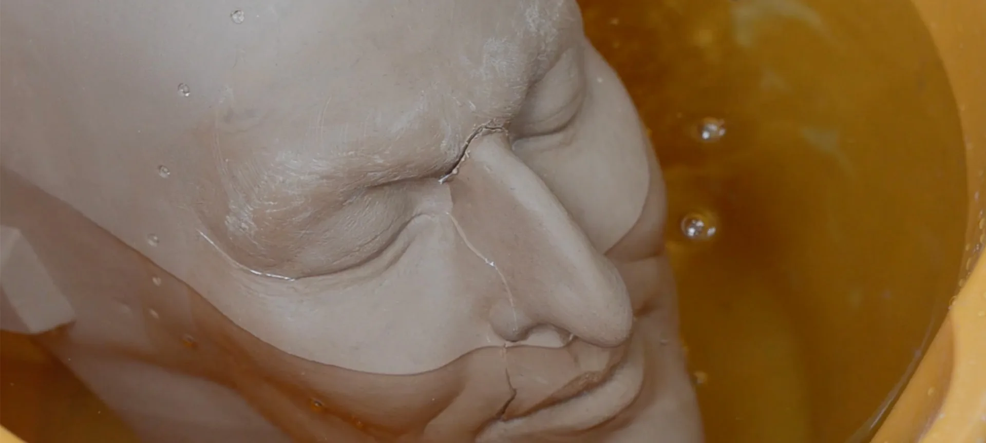 prosthetics